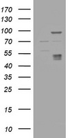 HEK293T cells were transfected with the pCMV6-ENTRY control (Left lane) or pCMV6-ENTRY CA12 (Right lane) cDNA for 48 hrs and lysed. Equivalent amounts of cell lysates (5 ug per lane) were separated by SDS-PAGE and immunoblotted with anti-CA12.
