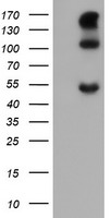 HEK293T cells were transfected with the pCMV6-ENTRY control (Left lane) or pCMV6-ENTRY CA12 (Right lane) cDNA for 48 hrs and lysed. Equivalent amounts of cell lysates (5 ug per lane) were separated by SDS-PAGE and immunoblotted with anti-CA12.