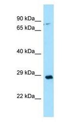 CA13 / Carbonic Anhydrase XIII antibody Western Blot of THP-1.
