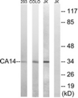 Western blot of extracts from Jurkat/COLO/293 cells, using CA14 Antibody. The lane on the right is treated with the synthesized peptide.