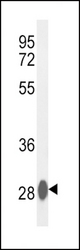 Western blot of CA3 Antibody in mouse liver tissue lysates (35 ug/lane). CA3 (arrow) was detected using the purified antibody.