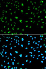 Immunofluorescence analysis of HeLa cell using CA3 antibody. Blue: DAPI for nuclear staining.