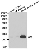 Western blot analysis of extracts of various cell lines, using CA3 antibody.