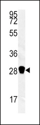 Western blot of CA3 antibody in mouse kidney tissue lysates (35 ug/lane). CA3 (arrow) was detected using the purified antibody.