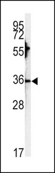 Western blot of CA3 antibody in HepG2 cell line lysates (35 ug/lane). CA3 (arrow) was detected using the purified antibody.
