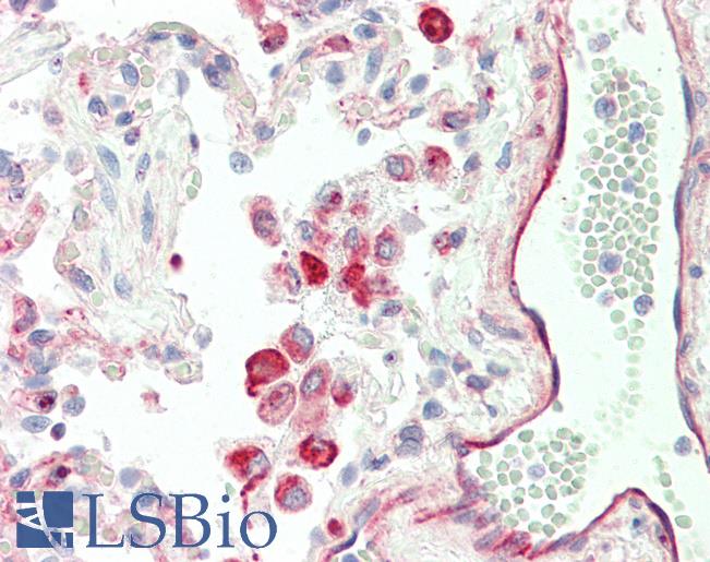 Human, Lung: Formalin-Fixed Paraffin-Embedded (FFPE)