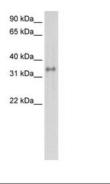 Fetal Lung Lysate
