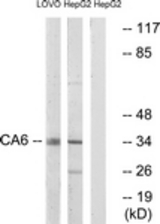 Western blot of extracts from HepG2/LOVO cells, using CA6 Antibody. The lane on the right is treated with the synthesized peptide.