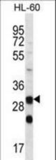 CA6 Antibody western blot of HL-60 cell line lysates (35 ug/lane). The CA6 antibody detected the CA6 protein (arrow).