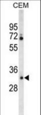 Western blot of CA6 Antibody in CEM cell line lysates (35 ug/lane). CA6 (arrow) was detected using the purified antibody.