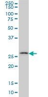 CA7 monoclonal antibody (M06), clone 3B7 Western Blot analysis of CA7 expression in HeLa NE.