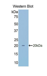 Western blot of recombinant CA7 / Carbonic Anhydrase VII.