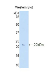 Western blot of recombinant CA7 / Carbonic Anhydrase VII.