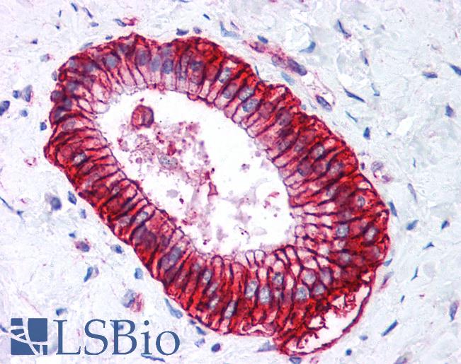 Anti-CA9 / Carbonic Anhydrase IX antibody IHC of human liver. Immunohistochemistry of formalin-fixed, paraffin-embedded tissue after heat-induced antigen retrieval. Antibody LS-B273 concentration 5 ug/ml.