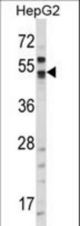 Western blot of CA9/G250:78-89 in HepG2 cell line lysates (35 ug/lane). CA9 (arrow) was detected using the purified antibody.