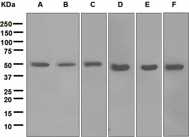 Western blot analysis on (A) HepG2, (B) SH-SY5Y, (C) fetal liver, (D) rat brain, (E) rat kidney, and (F) mouse brain lysates using anti-ABAT antibody.