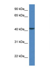 CAB39L antibody LS-C135873 Western blot of COL0205 Cell lysate. Antibody concentration 1 ug/ml.