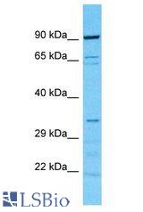 CAB39L antibody Western Blot of HeLa. Antibody dilution: 1 ug/ml.