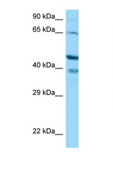 CABP1 antibody LS-C146557 Western blot of Jurkat Cell lysate. Antibody concentration 1 ug/ml.