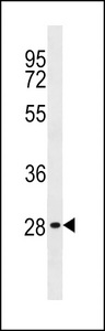 CABP1 Antibody western blot of Jurkat cell line lysates (35 ug/lane). The CABP1 antibody detected the CABP1 protein (arrow).