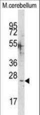 Western blot of anti-CABP1 Antibody in mouse cerebellum tissue lysates (35 ug/lane). CABP1(arrow) was detected using the purified antibody.