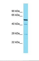Western blot of Rat Lung. Cabp4 antibody dilution 1.0 ug/ml.