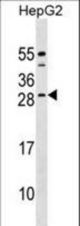 CABP4 Antibody western blot of HepG2 cell line lysates (35 ug/lane). The CABP4 antibody detected the CABP4 protein (arrow).