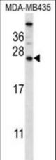 CABP5 Antibody western blot of MDA-MB435 cell line lysates (35 ug/lane). The CABP5 antibody detected the CABP5 protein (arrow).