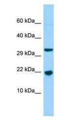 CABP5 antibody Western Blot of Fetal Liver.