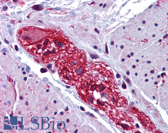 Anti-CABP7 antibody IHC of human colon, submucosal plexus. Immunohistochemistry of formalin-fixed, paraffin-embedded tissue after heat-induced antigen retrieval. Antibody LS-B5311 concentration 2.5 ug/ml.