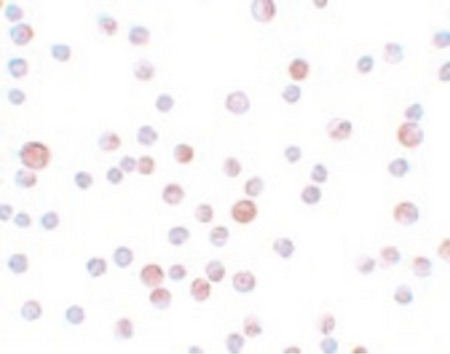 Immunocytochemistry of CaBP7 in HeLa cells with CaBP7 antibody at 4 ug/ml.