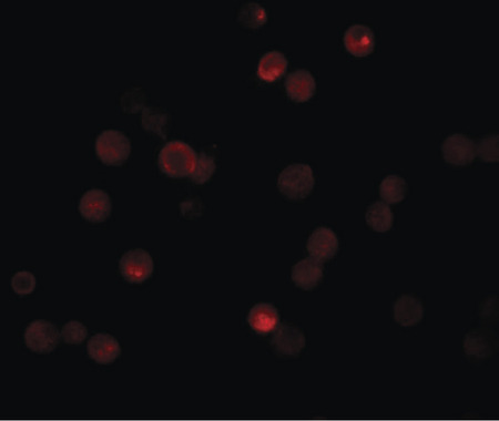 Immunofluorescence of CABP7 in HeLa cells with CAPB7 antibody at 20 ug/ml.