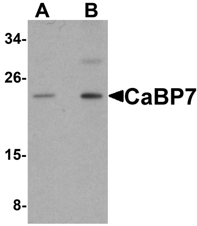 Western blot analysis of CaBP7 in HeLa cell lysate with CaBP7 antibody at (A) 1 and (B) 2 ug/ml.