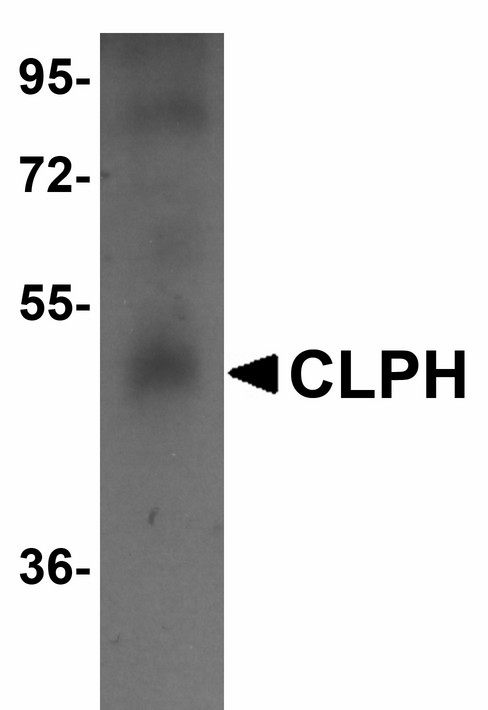 Western blot of CLPH in human testis tissue lysate with CLPH antibody at 1 ug/ml.