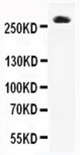 WB of CACNA1A / Cav2.1 antibody. All lanes: Anti-CACNA1A at 0.5ug/ml. Lane 1: Rat Brain Tissue Lysate at 40ug. Predicted bind size: 282KD. Observed bind size: 282KD.