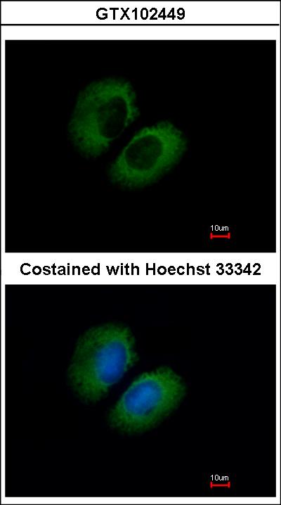 Immunofluorescence of methanol-fixed A549 using CACNA1B antibody at 1:500 dilution.
