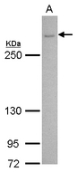 CACNA1B antibody [C3], C-term detects CACNA1B protein by Western blot analysis. A. 30 ug U87-MG whole cell lysate/extract. 5 % SDS-PAGE. CACNA1B antibody [C3], C-term dilution:1:500