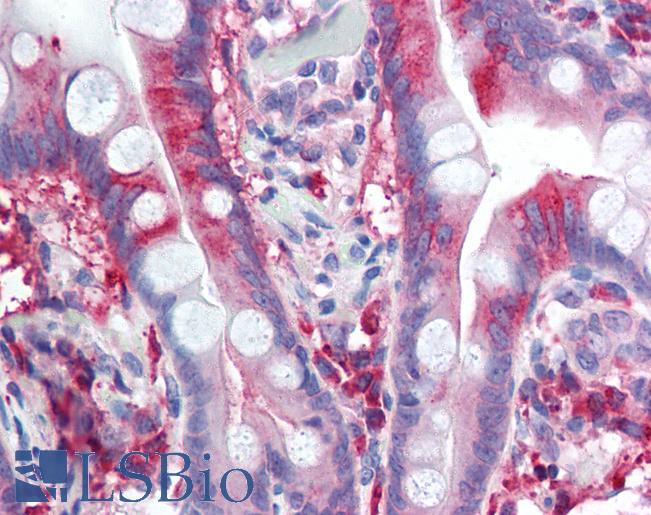 Anti-CACNA1C / Cav1.2 antibody LS-A9663 IHC of human small intestine. Immunohistochemistry of formalin-fixed, paraffin-embedded tissue after heat-induced antigen retrieval.