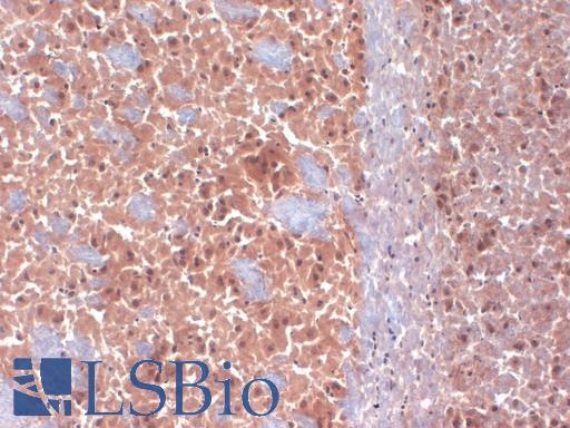 IHC analysis of CACNA1D / Cav1.3 antibody on frozen mouse brain.