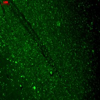 Cav1.3 (S38-8), Human hippocampus.