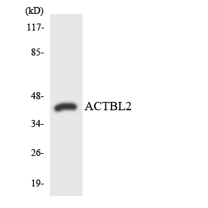 Western blot of the lysates from HUVEC cells using ACTBL2 antibody.