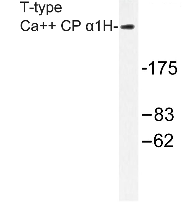 Western blot of T-type Ca++ CP 1H (P492) pAb in extracts from A549 cells.