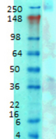 Western blot analysis of Cav3.1 in rat brain membrane tissues, using a 1:1000 dilution of CACNA1G / Cav3.1 antibody.