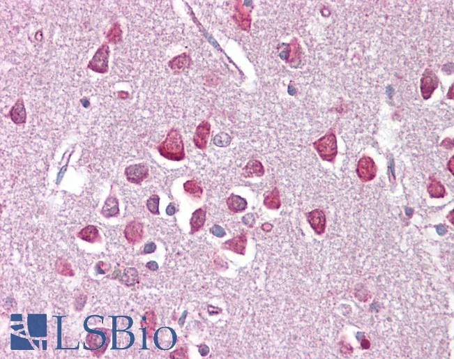 Anti-CACNA1G / Cav3.1 antibody IHC of human brain, cortex. Immunohistochemistry of formalin-fixed, paraffin-embedded tissue after heat-induced antigen retrieval. Antibody LS-B6610 concentration 2.5 ug/ml.