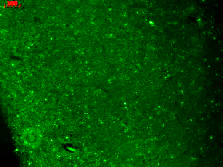 Cav3.2 (S55-10), Human hippocampus.