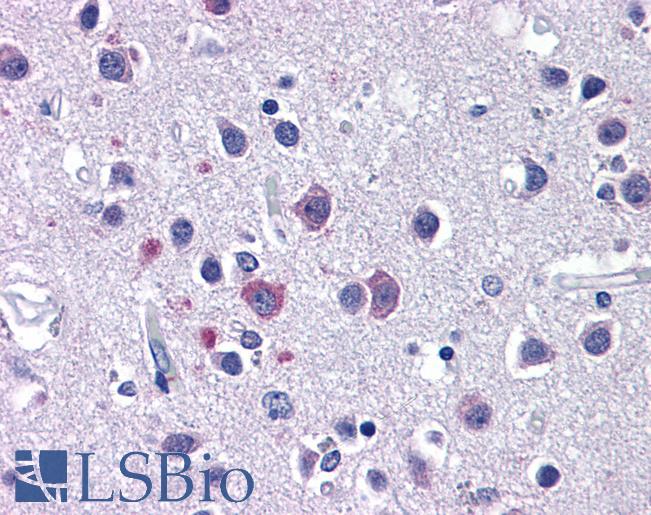 Anti-CACNA1I / Cav3.3 antibody IHC of human brain, cortex. Immunohistochemistry of formalin-fixed, paraffin-embedded tissue after heat-induced antigen retrieval. Antibody LS-B5617 concentration 5 ug/ml.