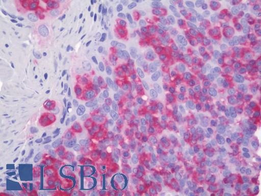 Anti-ACTBL2 antibody IHC staining of human tonsil. Immunohistochemistry of formalin-fixed, paraffin-embedded tissue after heat-induced antigen retrieval. Antibody LS-B10935 dilution 1:100.