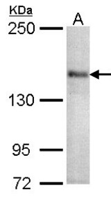 Sample (30 ug of whole cell lysate). A:293T. 5% SDS PAGE. CACNA1S antibody diluted at 1:1000.