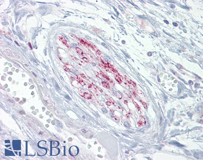 Anti-CACNA2D1 antibody IHC of human nerve. Immunohistochemistry of formalin-fixed, paraffin-embedded tissue after heat-induced antigen retrieval. Antibody LS-B6739 concentration 10 ug/ml.