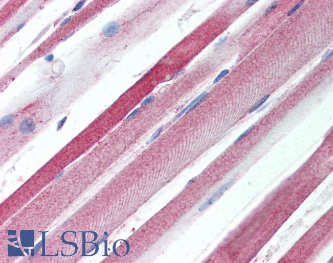 Anti-CACNA2D1 antibody IHC of human skeletal muscle. Immunohistochemistry of formalin-fixed, paraffin-embedded tissue after heat-induced antigen retrieval. Antibody LS-B162 concentration 2.5 ug/ml.